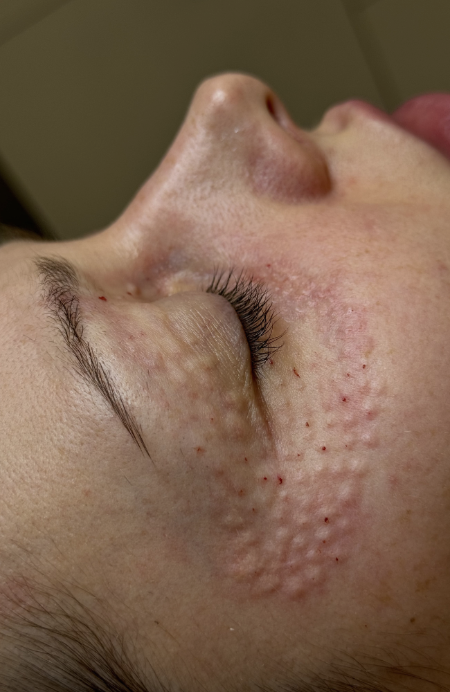 skin quality einblick 1